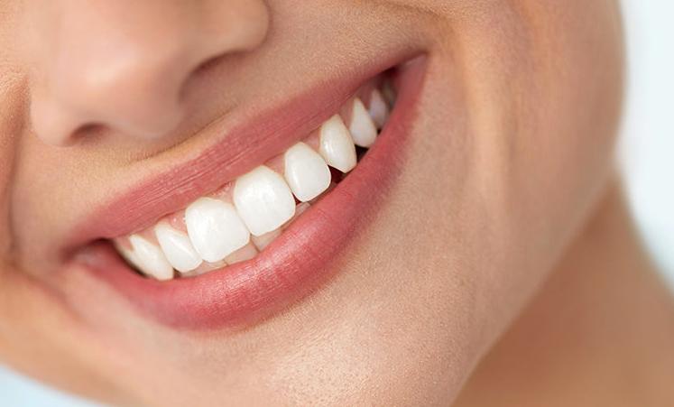 Cosmetic-Bonding