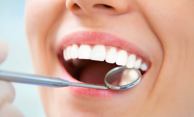 Periodontal-maintenance-cleanings