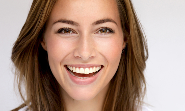 Smile-Makeovers