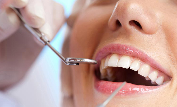 Teeth-Cleaning