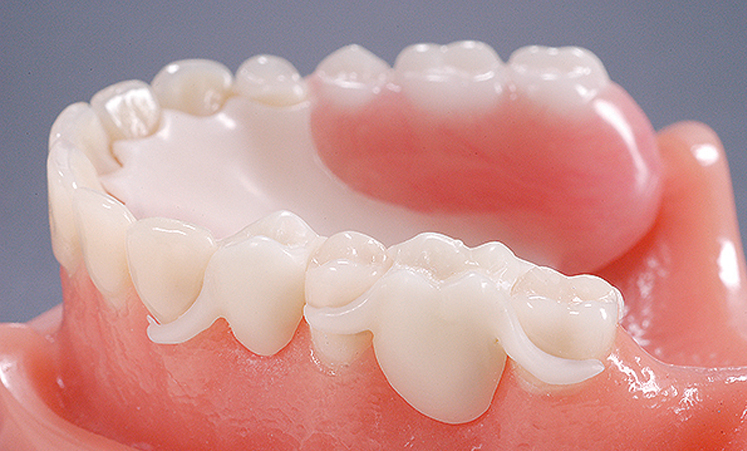 partial-denture