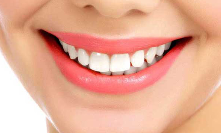 smile-design